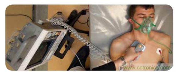 帶電極的醫院用除顫器。注意，患者身上有外部心電圖或心髒監護儀，從胸部的白色圓片(電極)和導聯(線)可看出來。