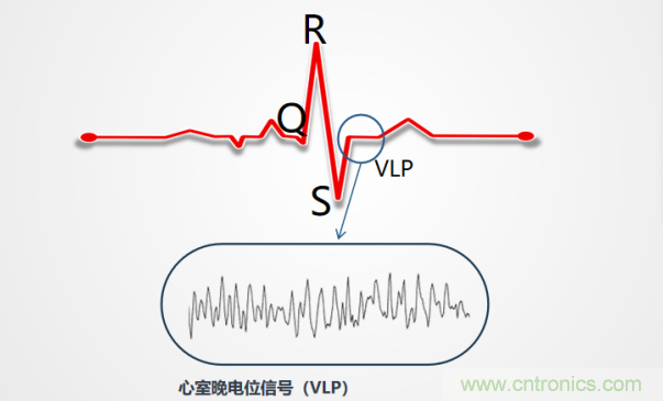 解決心電監測行業難題，曼森伯格的濾波技術獲國家知識產權局發明授權