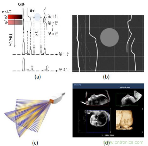 超聲係統的信號鏈設計注意事項
