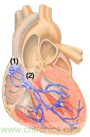 檢測並區分心髒起搏偽像