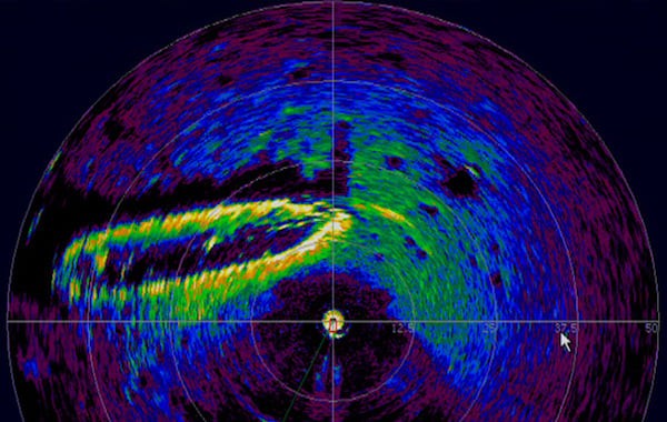 什麼是激光雷達以及如何使用它？