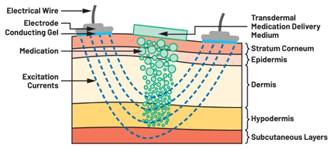  圖5.人體皮膚分層橫截麵以及TMD和生物阻抗測量  考慮到生物阻抗分析的無創性，使用兩個金屬電極代表電氣傳感器，連接模擬前端(AFE)電路和患者皮膚。這個金屬與非金屬的接觸點是構成整個電路的另一個關鍵部分，連接了AFE和人體電氣模型。電荷載體（電極中的電子和人體內的離子）之(zhi)間(jian)的(de)相(xiang)互(hu)作(zuo)用(yong)可(ke)能(neng)對(dui)這(zhe)些(xie)傳(chuan)感(gan)器(qi)的(de)性(xing)能(neng)產(chan)生(sheng)重(zhong)大(da)影(ying)響(xiang)，需(xu)要(yao)根(gen)據(ju)每(mei)種(zhong)應(ying)用(yong)進(jin)行(xing)具(ju)體(ti)考(kao)慮(lv)。首(shou)先(xian)，金(jin)屬(shu)與(yu)離(li)子(zi)溶(rong)液(ye)接(jie)觸(chu)的(de)相(xiang)互(hu)作(zuo)用(yong)導(dao)致(zhi)金(jin)屬(shu)表(biao)麵(mian)附(fu)近(jin)溶(rong)液(ye)中(zhong)離(li)子(zi)濃(nong)度(du)的(de)局(ju)部(bu)變(bian)化(hua)。這(zhe)種(zhong)現(xian)象(xiang)會(hui)改(gai)變(bian)電(dian)極(ji)下(xia)方(fang)區(qu)域(yu)的(de)電(dian)荷(he)中(zhong)性(xing)，導(dao)致(zhi)金(jin)屬(shu)周(zhou)圍(wei)的(de)電(dian)解(jie)質(zhi)電(dian)位(wei)與(yu)溶(rong)液(ye)其(qi)餘(yu)部(bu)分(fen)不(bu)同(tong)，從(cong)而(er)在(zai)金(jin)屬(shu)和(he)電(dian)解(jie)質(zhi)主(zhu)體(ti)之(zhi)間(jian)產(chan)生(sheng)一(yi)個(ge)電(dian)位(wei)差(cha)，即(ji)常(chang)說(shuo)的(de)“半電池電位”。其次，注入電流的直流分量會導致電極極化。  表1.各種電極類型和相應的半電池電位  金屬及反應  半電池電位(V)  Al → Al3+ + 3e- Al → Al3+ + 3e-  –1.706 –1.706  Ni → Ni2+ + 2e- Ni → Ni2+ + 2e-  –0.230 -0.230  H2 → 2H+ + 2e- H2 → 2H+ + 2e-  0.000 (by definition) 0.000（根據定義）  Ag + Cl- → AgCl + e- Ag + Cl- → AgCl + e-  +0.223 +0.223  Ag → Ag+ + e- Ag → Ag+ + e-  +0.799 +0.799  Au → Au+ + e- Au → Au+ + e-  +1.680 +1.680  這是一種不良現象，往往導致電極性能下降。這些考量表明，電極也需要定義適當的電氣模型（參見圖6）。我們可以將幹電極表示為具有三個串聯元件的電路：一個用於模擬半電池電位(EHC)的直流電源；一個用於模擬金屬和非金屬（人體）之間接觸的RC並聯電池(Rd||Cd)；以及一個用於模擬電極金屬的電阻Rs。
